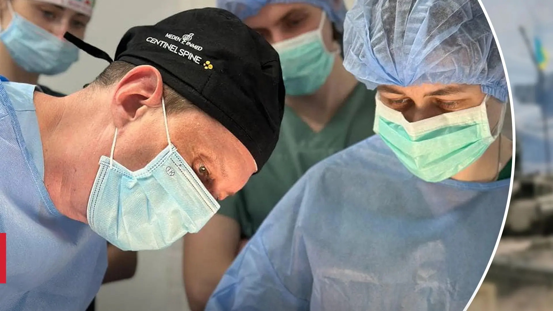 "Спрагла обличчям навіть від вітру": у Рівному вперше виконали унікальну хірургічну втручання.